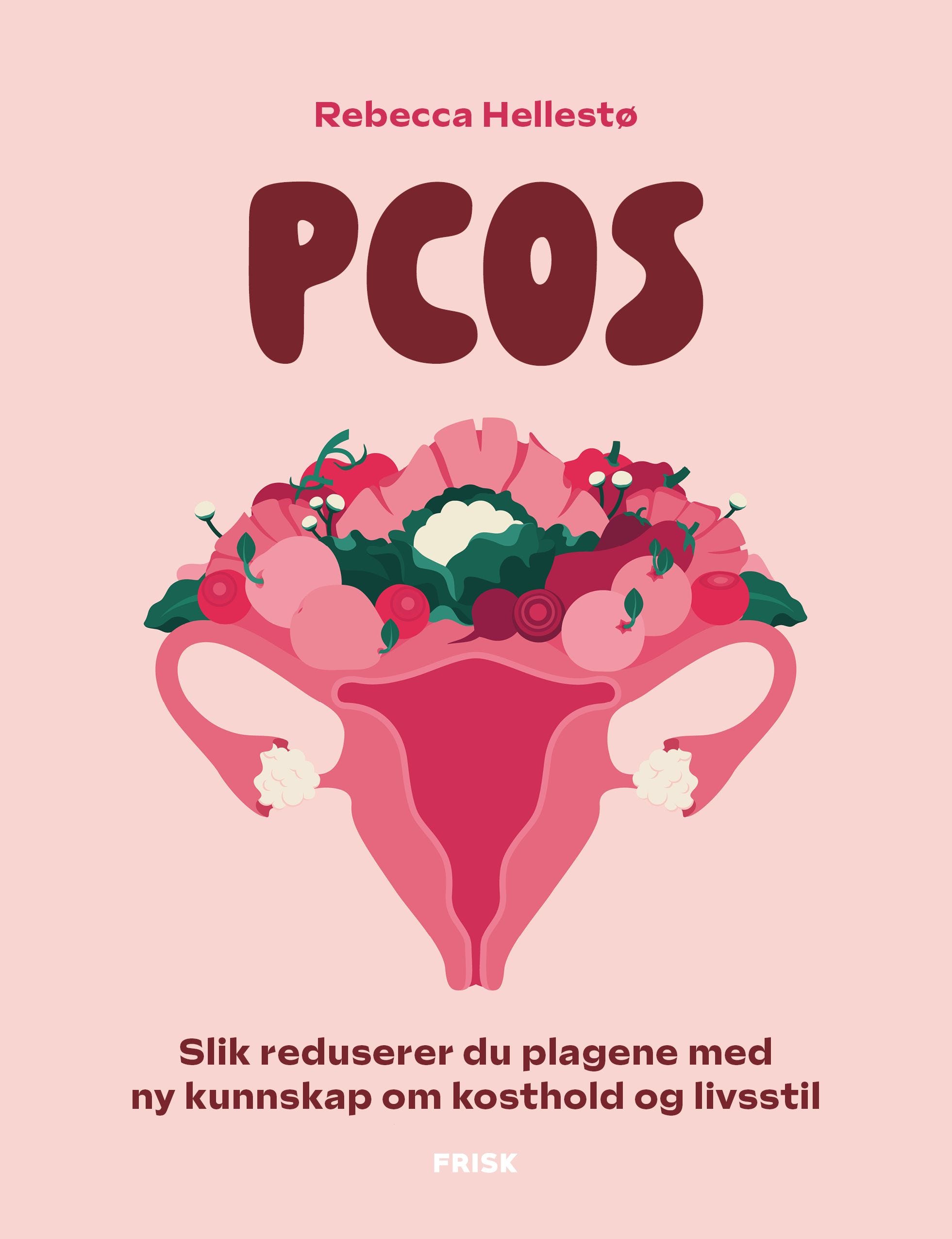 PCOS av Rebecca Hellestø